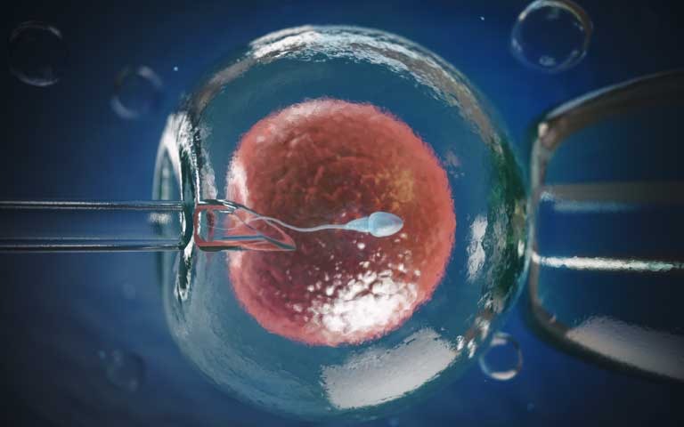 What is ivf ?